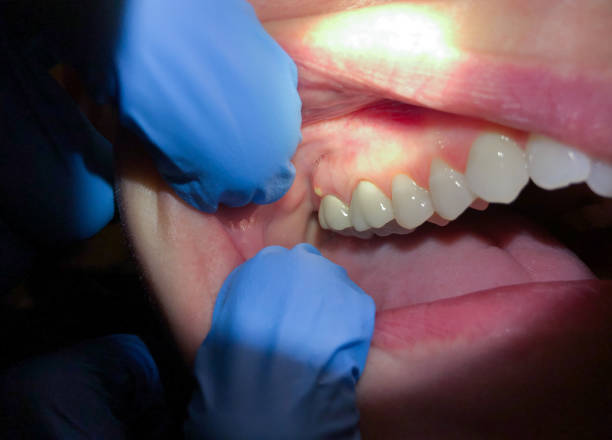 Best 24-Hour Emergency Dental Care in Anacoco, LA